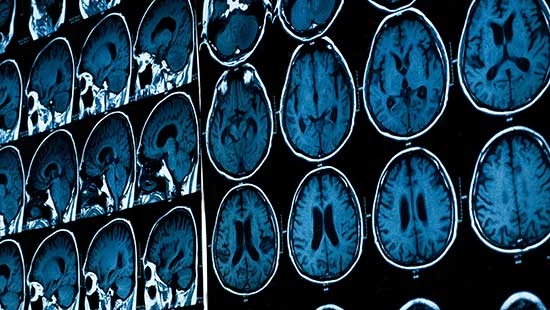 Images from a brain scan